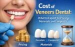 Cost of Veneers Dental: What to Expect for Pricing, Materials, and Longevity
